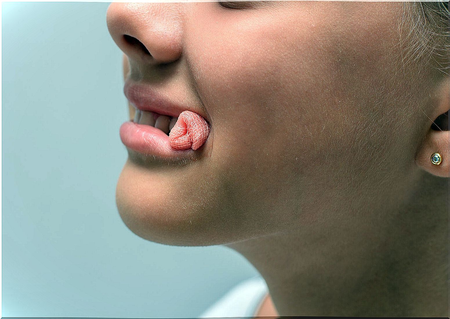 Little girl with gauze in her mouth.