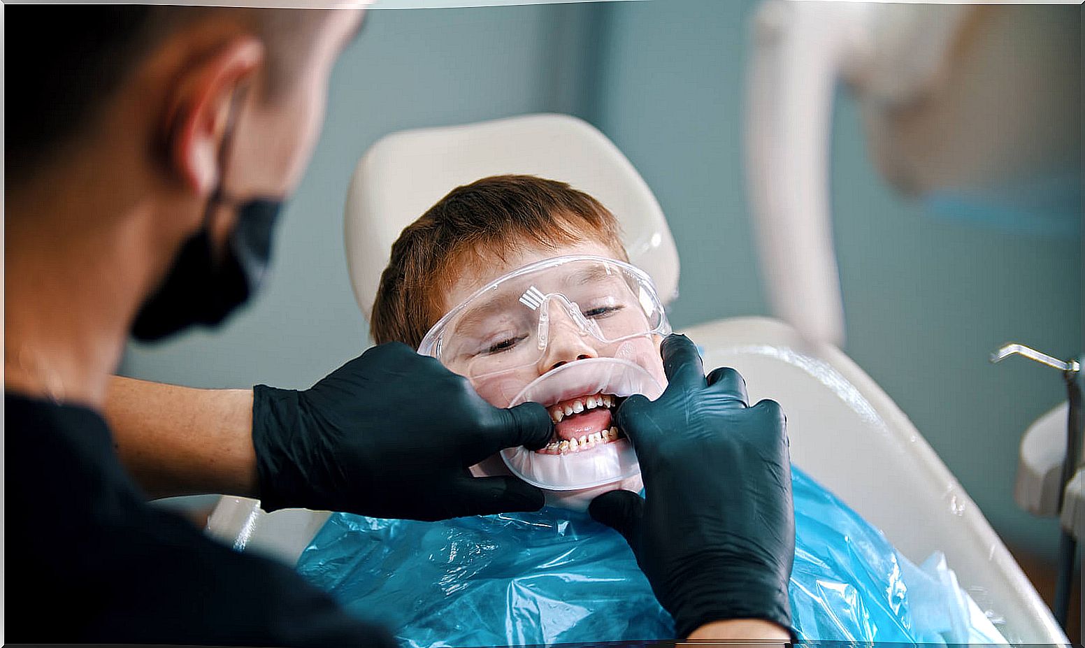 Child at the dentist having teeth sealed.