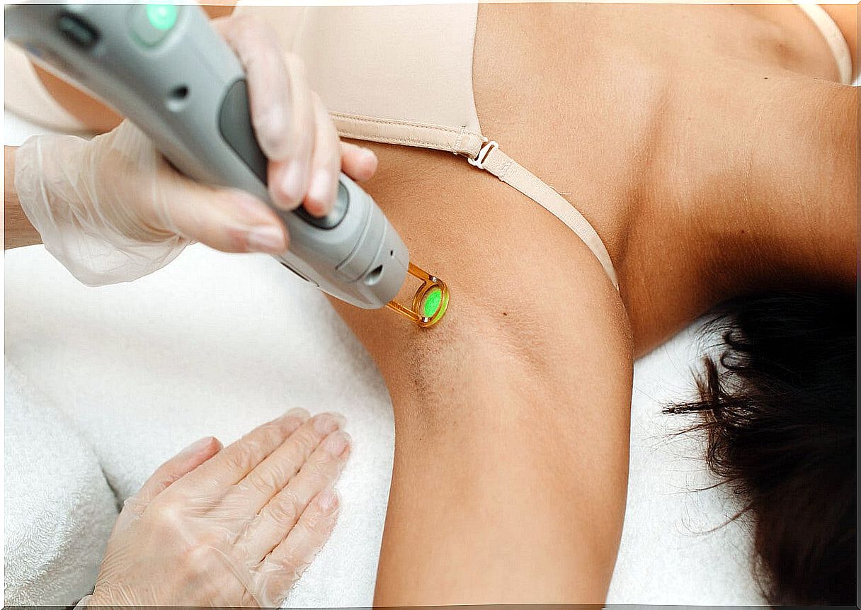 Laser hair removal in adolescents: everything you need to know