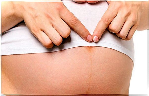 The linea alba, the "magic" mark of pregnancy